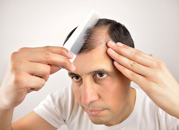 Hair Loss Treatment in Hyderabad | Experts Skin & Hair Clinic